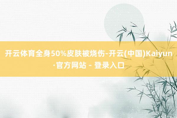 开云体育全身50%皮肤被烧伤-开云(中国)Kaiyun·官方网站 - 登录入口
